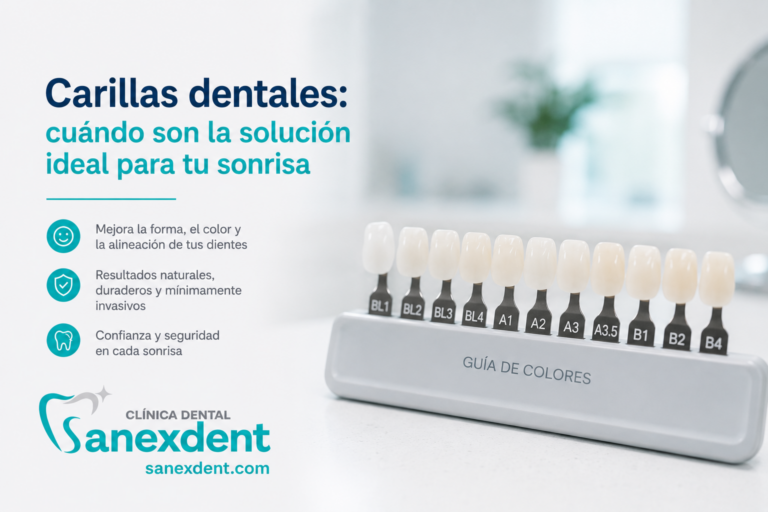 Carillas dentales: cuándo son la solución ideal para tu sonrisa