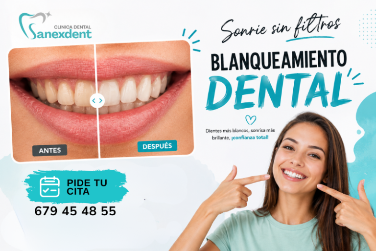 Blanqueamiento dental profesional en Viladecans